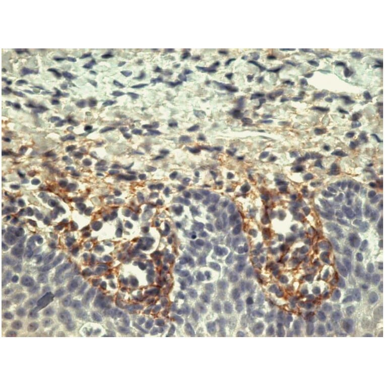 IHC - Anti-Tenascin C Antibody [T2H5] (A86776)