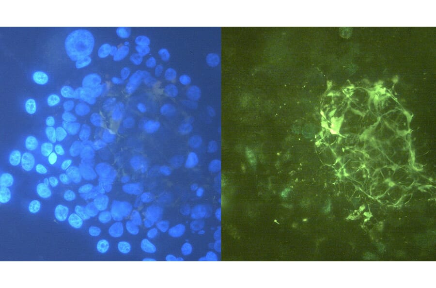 ICC - Anti-Tenascin C Antibody [T2H5] (A86776)