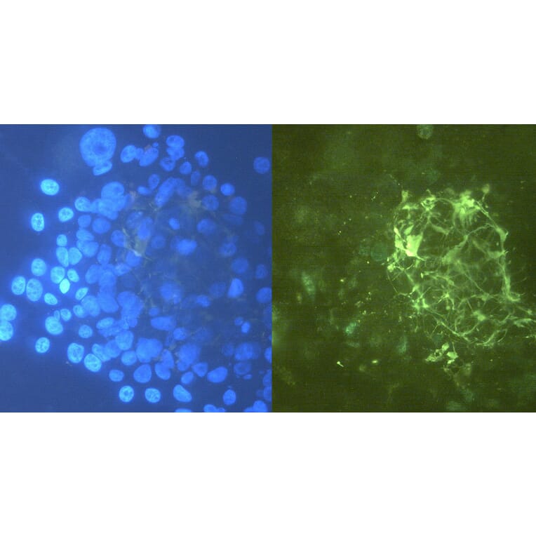 ICC - Anti-Tenascin C Antibody [T2H5] (A86776)