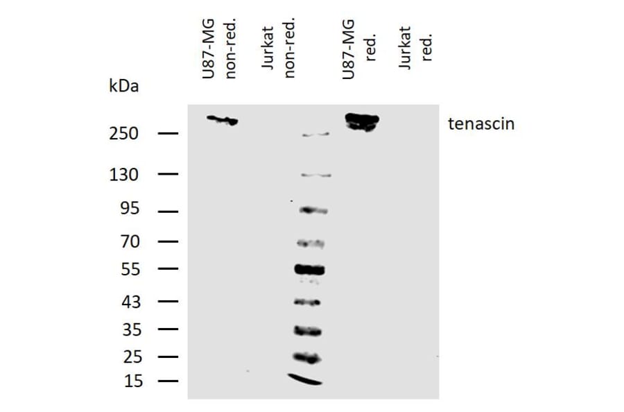 WB - Anti-Tenascin C Antibody [T2H5] (A86776)