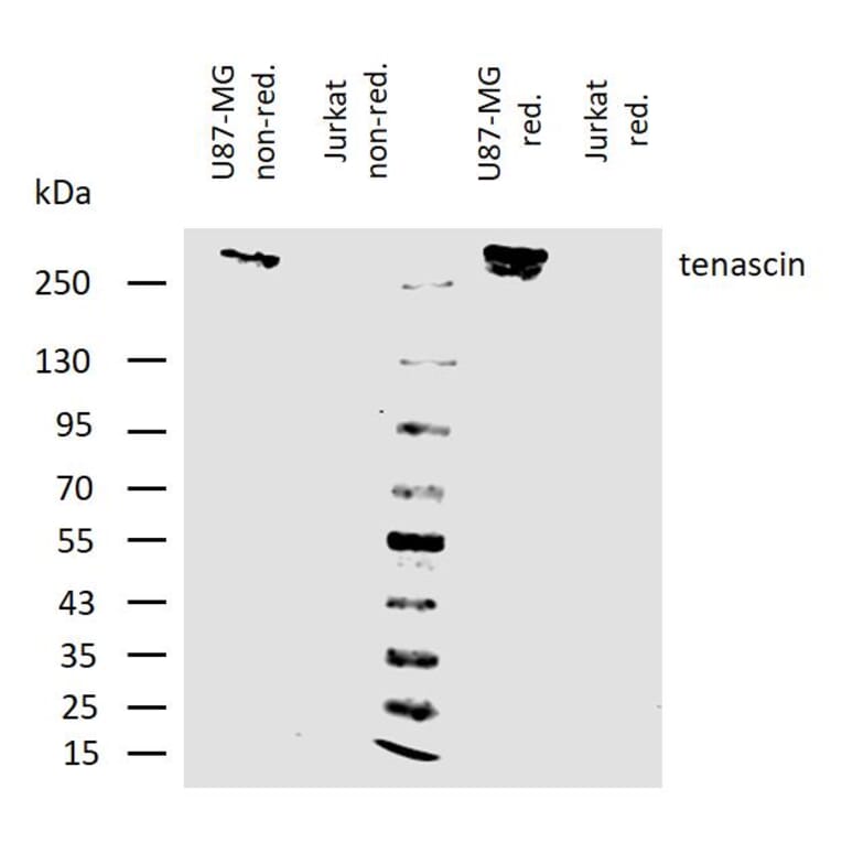 WB - Anti-Tenascin C Antibody [T2H5] (A86776)