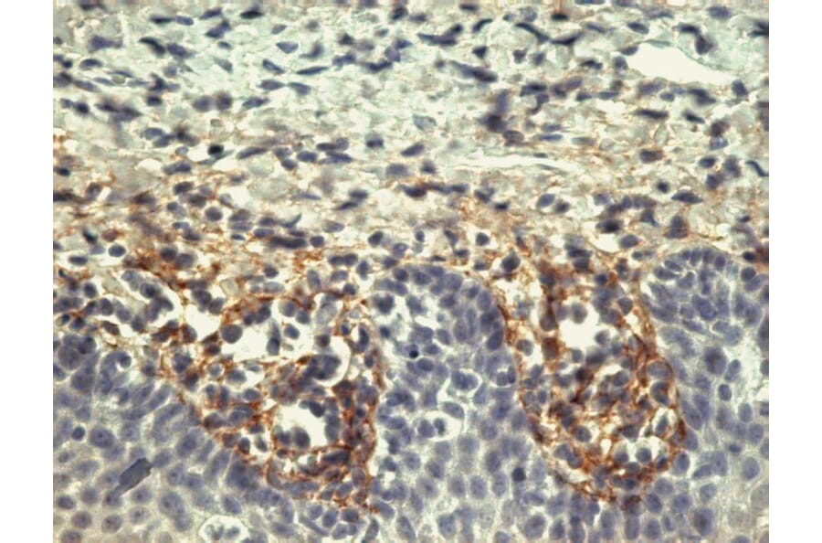 Immunohistochemistry - Anti-Tenascin Antibody [T2H5] (A86775) - Antibodies.com