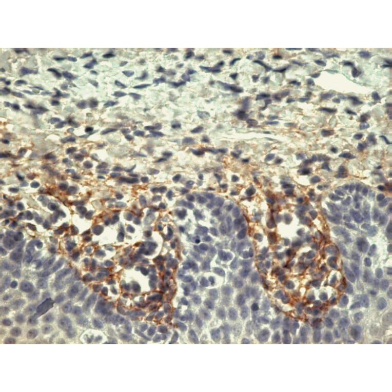 Immunohistochemistry - Anti-Tenascin Antibody [T2H5] (A86775) - Antibodies.com