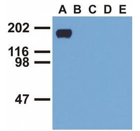 WB - Anti-EGFR (phospho Y992) Antibody [EM-12] (A86777)