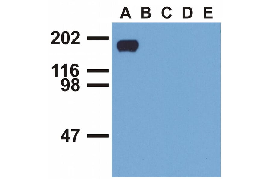 WB - Anti-EGFR (phospho Y992) Antibody [EM-12] (A86777)