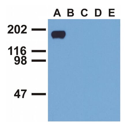 WB - Anti-EGFR (phospho Y992) Antibody [EM-12] (A86777)