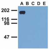 WB - Anti-EGFR (phospho Y992) Antibody [EM-12] (A86777)