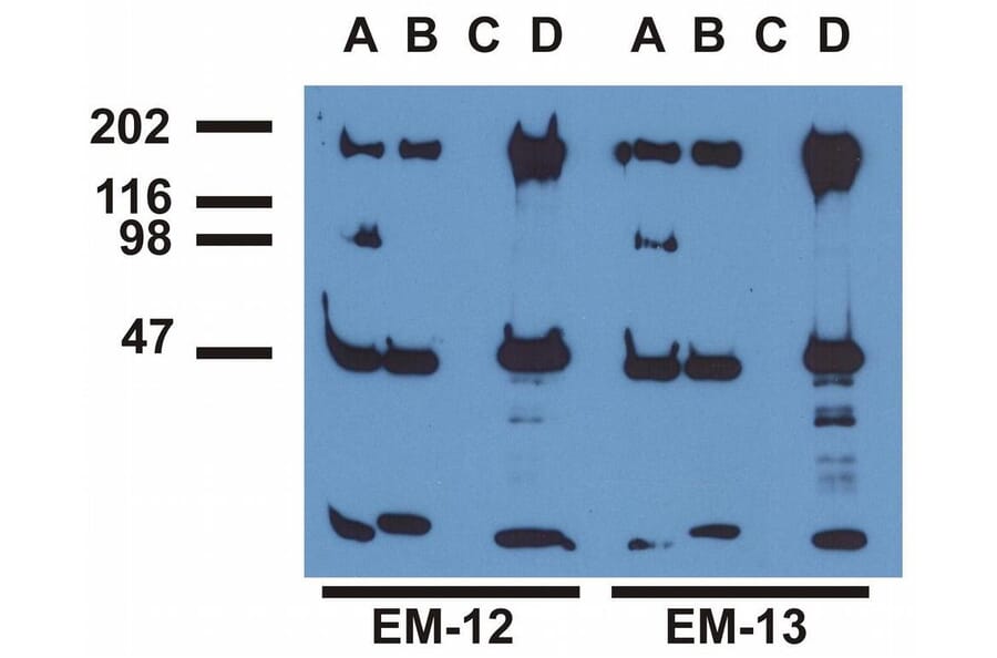 IP - Anti-EGFR (phospho Y992) Antibody [EM-12] (A86777)