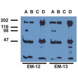 IP - Anti-EGFR (phospho Y992) Antibody [EM-12] (A86777)
