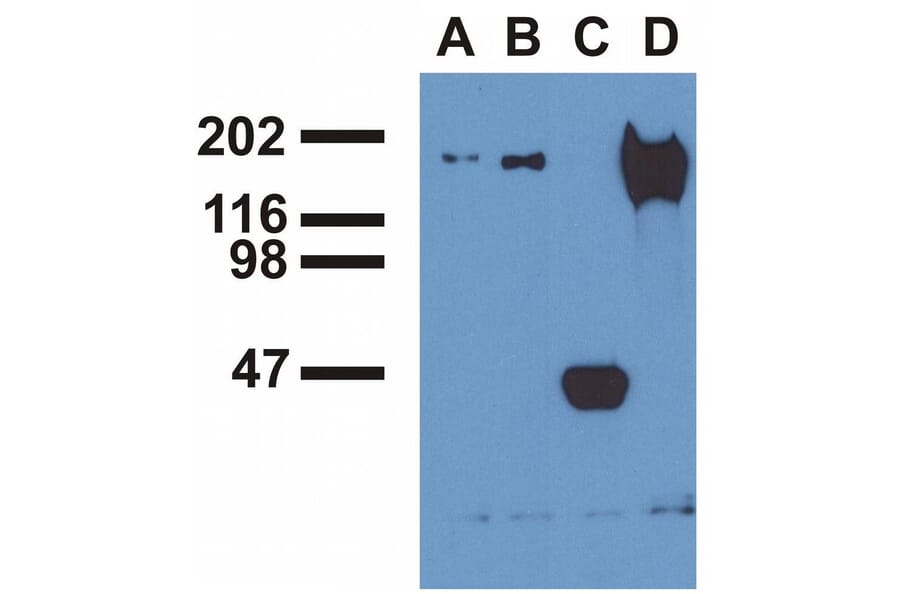 IP - Anti-EGFR (phospho Y992) Antibody [EM-12] (A86777)