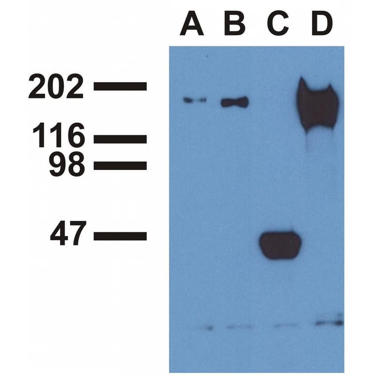 IP - Anti-EGFR (phospho Y992) Antibody [EM-12] (A86777)