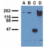 IP - Anti-EGFR (phospho Y992) Antibody [EM-12] (A86777)