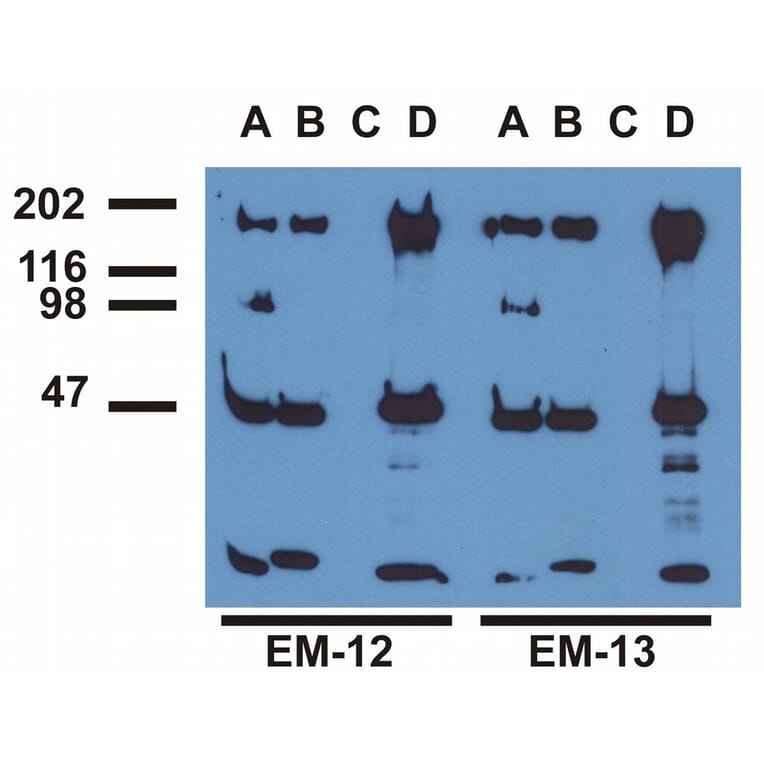 Immunoprecipitation - Anti-EGFR (phospho Tyr992) Antibody [EM-12] (A86776) - Antibodies.com