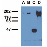 Immunoprecipitation - Anti-EGFR (phospho Tyr992) Antibody [EM-12] (A86777) - Antibodies.com
