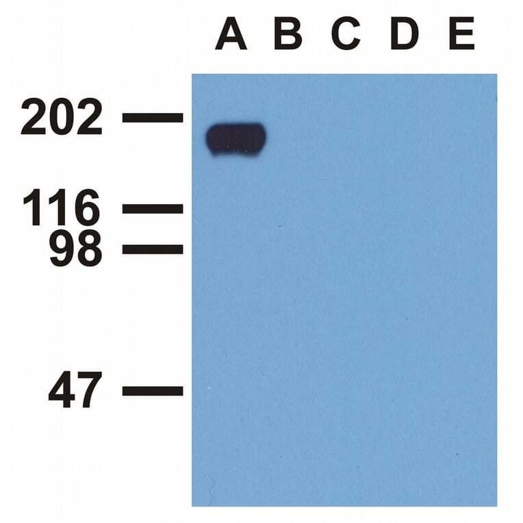 Western Blot - Anti-EGFR (phospho Tyr992) Antibody [EM-12] (A86777) - Antibodies.com