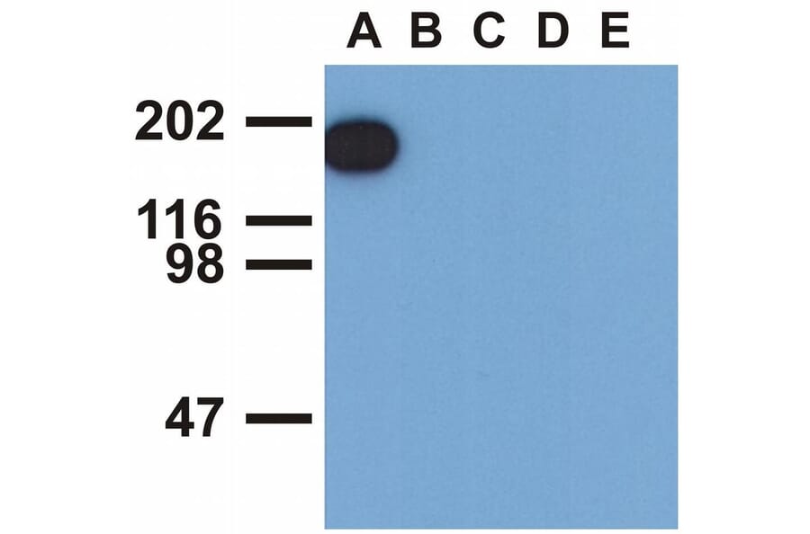 WB - Anti-EGFR (phospho Y1173) Antibody [EM-13] (A86778)