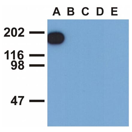 WB - Anti-EGFR (phospho Y1173) Antibody [EM-13] (A86778)