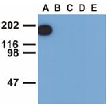 WB - Anti-EGFR (phospho Y1173) Antibody [EM-13] (A86778)
