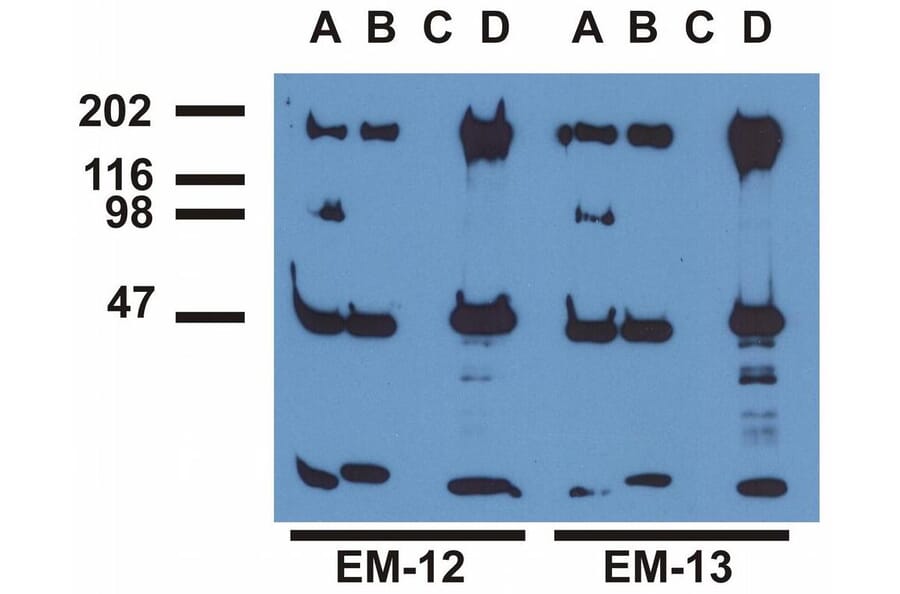 IP - Anti-EGFR (phospho Y1173) Antibody [EM-13] (A86778)
