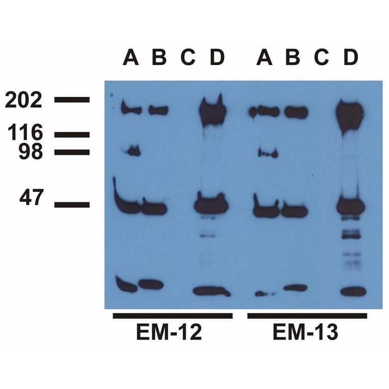 IP - Anti-EGFR (phospho Y1173) Antibody [EM-13] (A86778)