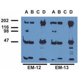 IP - Anti-EGFR (phospho Y1173) Antibody [EM-13] (A86778)