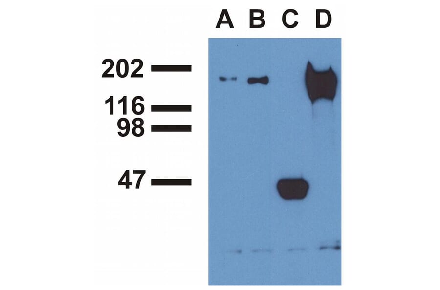 IP - Anti-EGFR (phospho Y1173) Antibody [EM-13] (A86778)