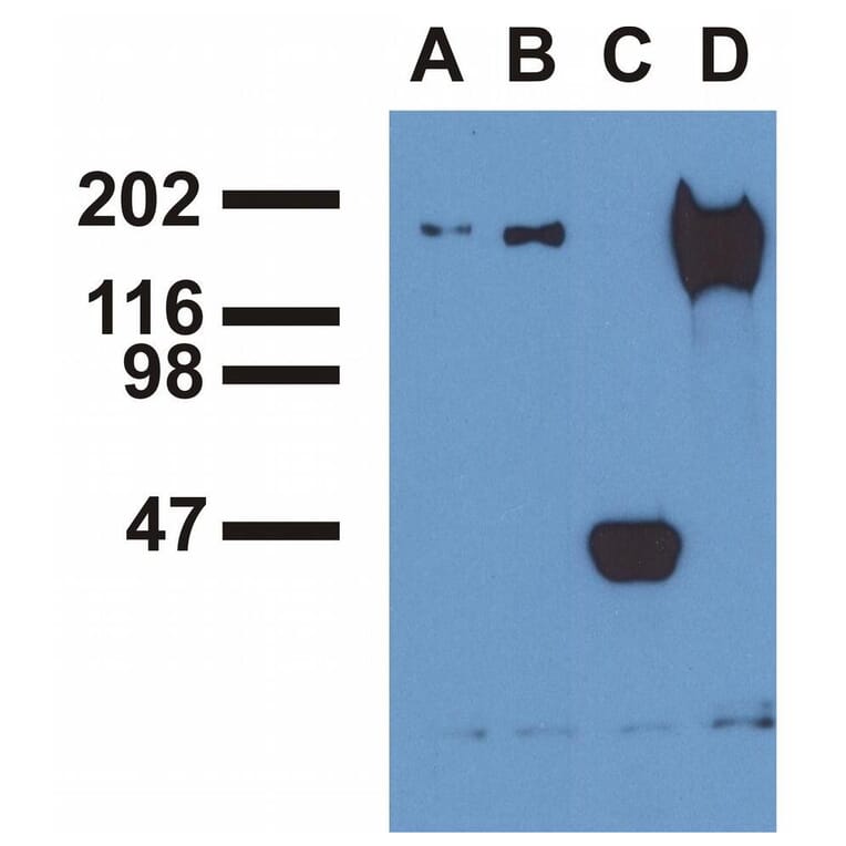 IP - Anti-EGFR (phospho Y1173) Antibody [EM-13] (A86778)