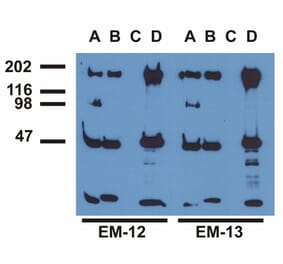 Immunoprecipitation - Anti-EGFR (phospho Tyr1173) Antibody [EM-13] (A86777) - Antibodies.com