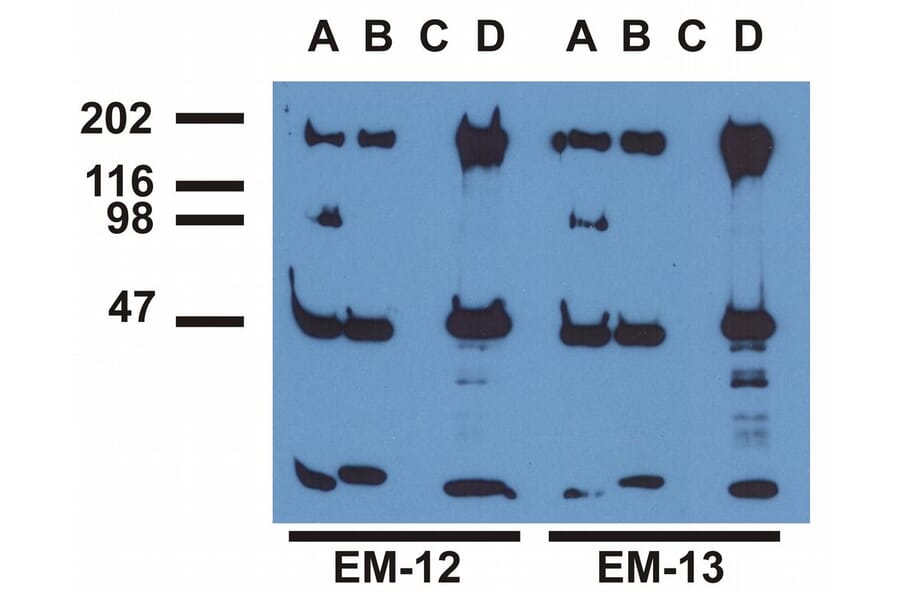 Immunoprecipitation - Anti-EGFR (phospho Tyr1173) Antibody [EM-13] (A86777) - Antibodies.com