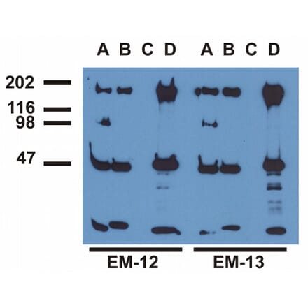 Immunoprecipitation - Anti-EGFR (phospho Tyr1173) Antibody [EM-13] (A86777) - Antibodies.com