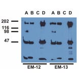 Immunoprecipitation - Anti-EGFR (phospho Tyr1173) Antibody [EM-13] (A86777) - Antibodies.com