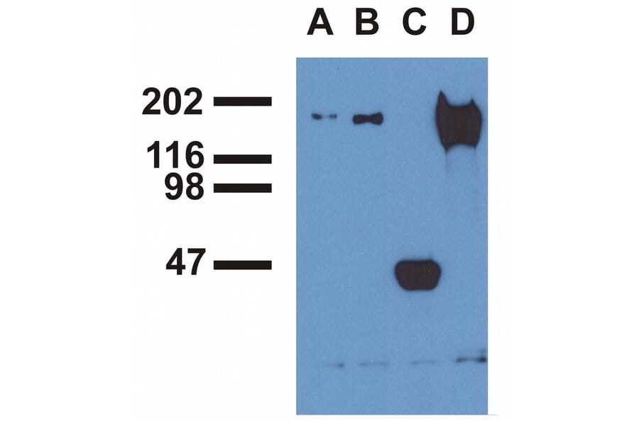 Immunoprecipitation - Anti-EGFR (phospho Tyr1173) Antibody [EM-13] (A86778) - Antibodies.com