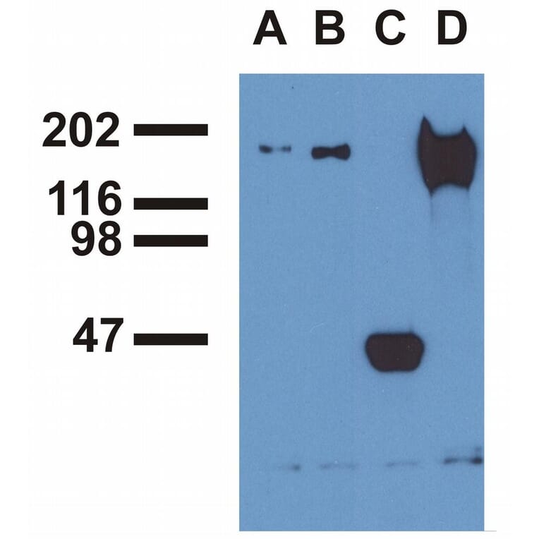 Immunoprecipitation - Anti-EGFR (phospho Tyr1173) Antibody [EM-13] (A86778) - Antibodies.com