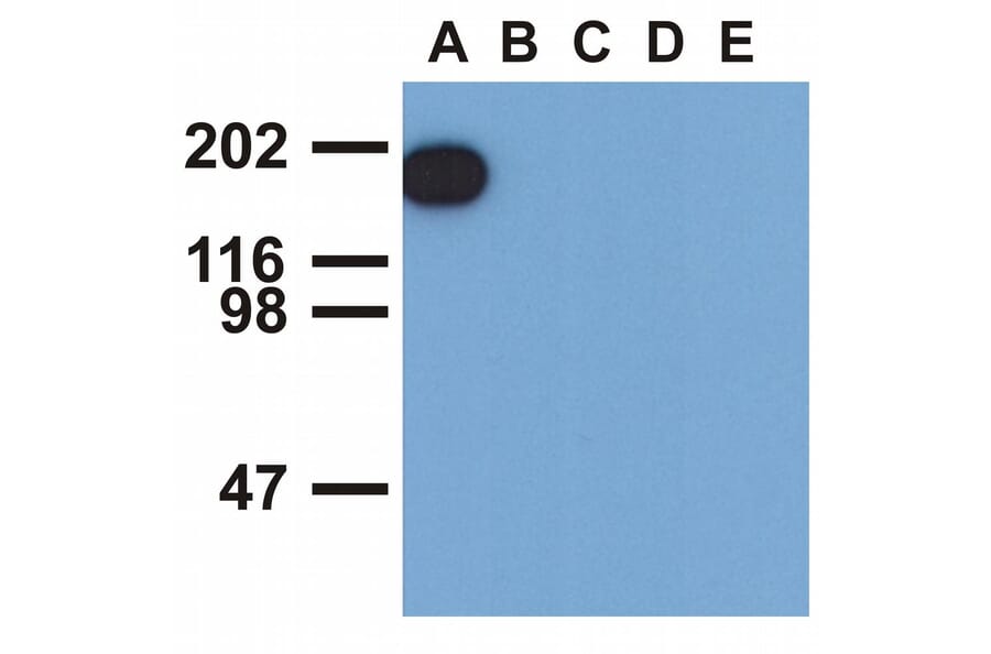 Western Blot - Anti-EGFR (phospho Tyr1173) Antibody [EM-13] (A86778) - Antibodies.com