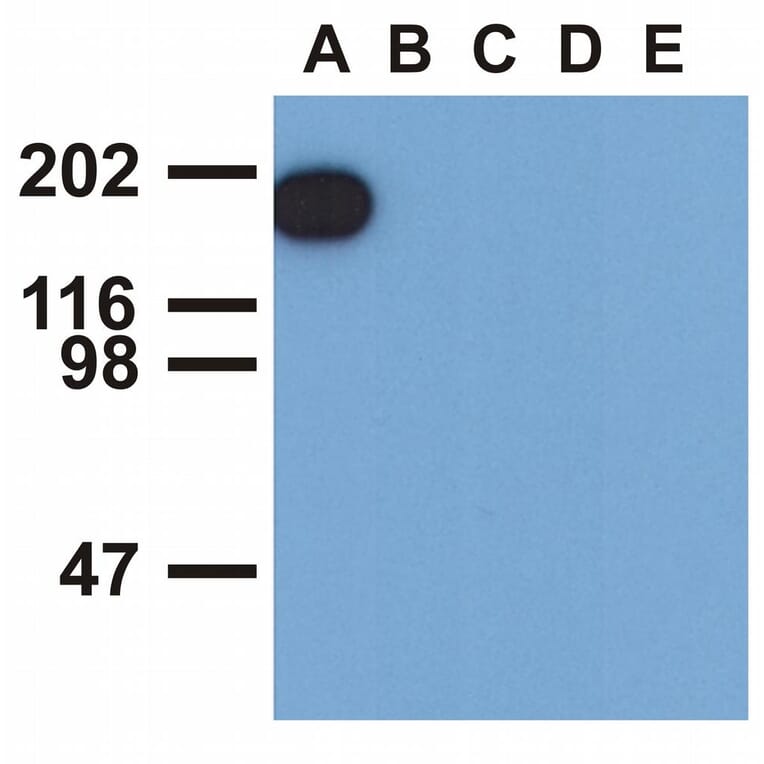 Western Blot - Anti-EGFR (phospho Tyr1173) Antibody [EM-13] (A86778) - Antibodies.com
