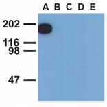 Western Blot - Anti-EGFR (phospho Tyr1173) Antibody [EM-13] (A86778) - Antibodies.com