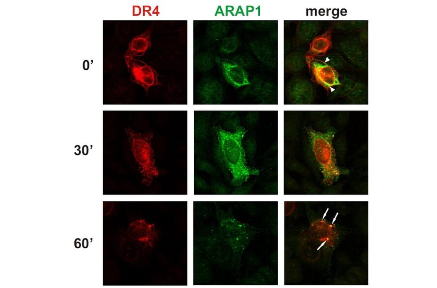 Immunocytochemistry - Anti-ARAP1 Antibody [ARAP1-2] (A86778) - Antibodies.com