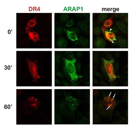 Immunocytochemistry - Anti-ARAP1 Antibody [ARAP1-2] (A86778) - Antibodies.com