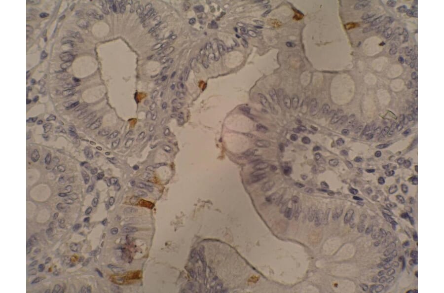Immunohistochemistry - Anti-Sialyl Lewis a Antibody [121SLE] (A86796) - Antibodies.com