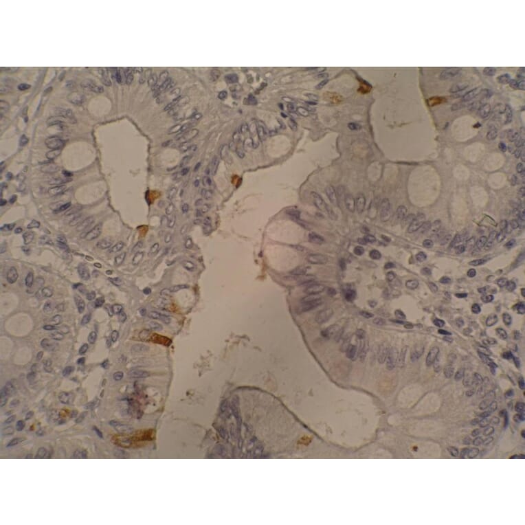 Immunohistochemistry - Anti-Sialyl Lewis a Antibody [121SLE] (A86796) - Antibodies.com