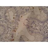 Immunohistochemistry - Anti-Sialyl Lewis a Antibody [121SLE] (A86796) - Antibodies.com