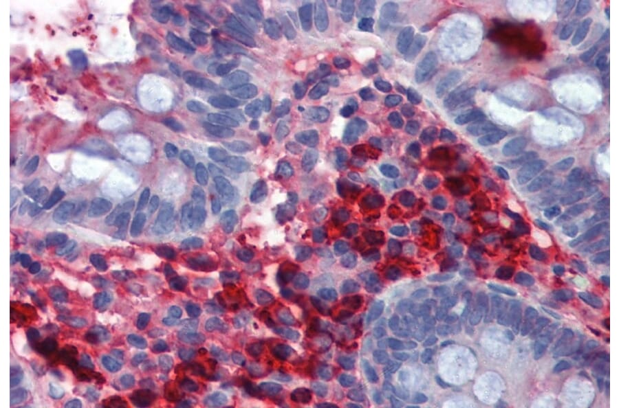 Immunohistochemistry - Anti-Human IgA Antibody [AD3] (A86801) - Antibodies.com