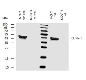 WB - Anti-Clusterin Antibody [Hs-3] (A86810)