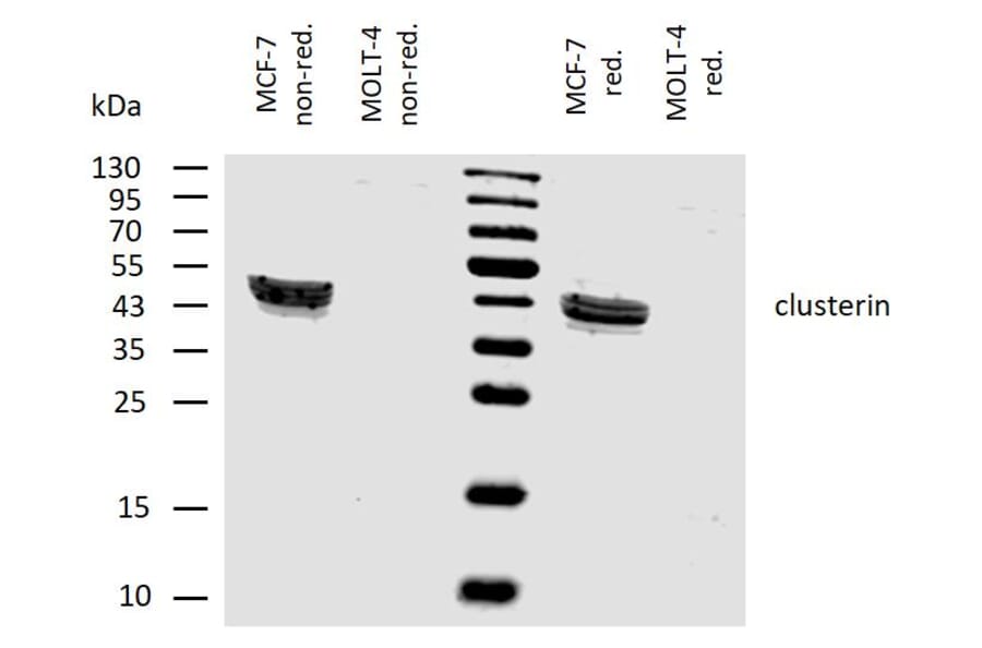 WB - Anti-Clusterin Antibody [Hs-3] (A86810)