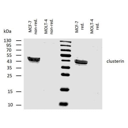 WB - Anti-Clusterin Antibody [Hs-3] (A86810)