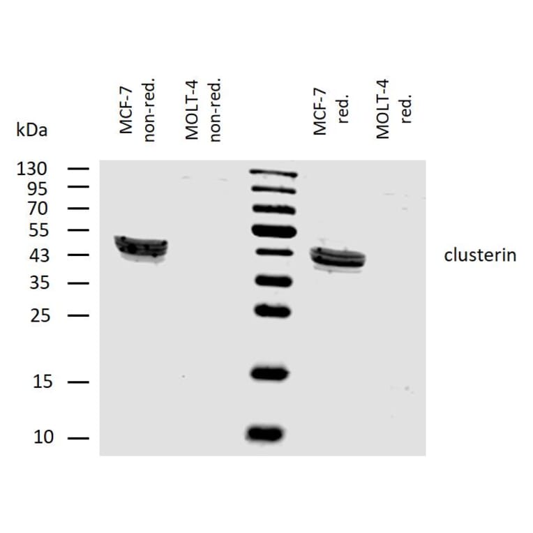 WB - Anti-Clusterin Antibody [Hs-3] (A86810)