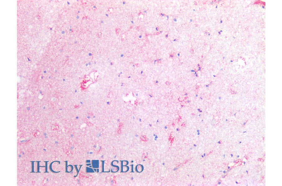 IHC - Anti-Tissue Factor Antibody [HTF-1] (A86828)