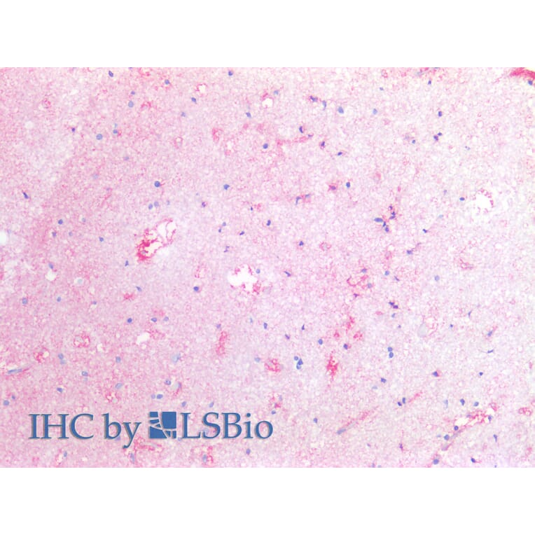 IHC - Anti-Tissue Factor Antibody [HTF-1] (A86828)