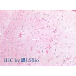 IHC - Anti-Tissue Factor Antibody [HTF-1] (A86828)