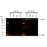 WB - Anti-CD222 Antibody [MEM-240] (A86836)